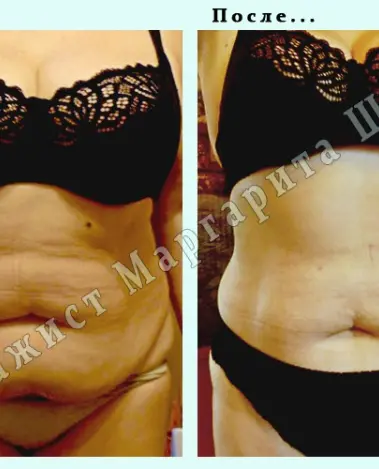 Анкета массажистки Маргарита - Фото 3, район МПС, 43 года, №2540